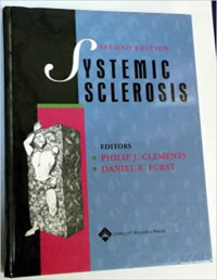 Image of Systemic sclerosis