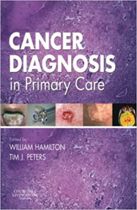 Image of Cancer diagnosis in primary care