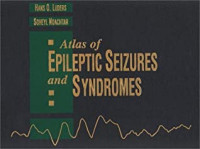 Image of Atlas of Epileptic seizures and syndromes