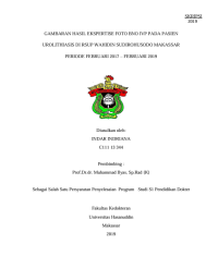 Image of Gambaran hasil ekspertise foto bno ivp pada pasien urolithiasis di rsup wahidin sudirohusodo makassar periode februari 2017 – februari 2019