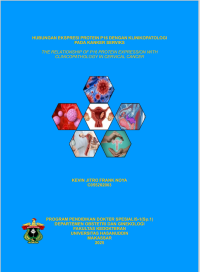 Image of Hubungan ekspresi protein p16 dengan klinikopatologi pada kanker serviks