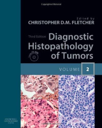 Image of Diagnostic histopathology of tumors