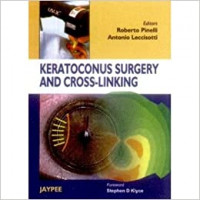Image of Keratoconus surgery and cross-linking