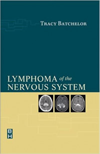 Image of Lymphoma of the nervous system