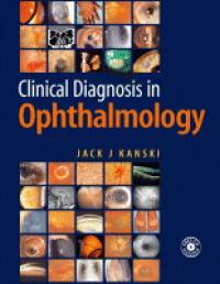 Image of Clinical diagnosis in Ophthalmology
