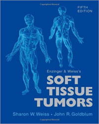 Image of Soft Tissue tumors